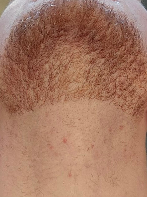 After photo